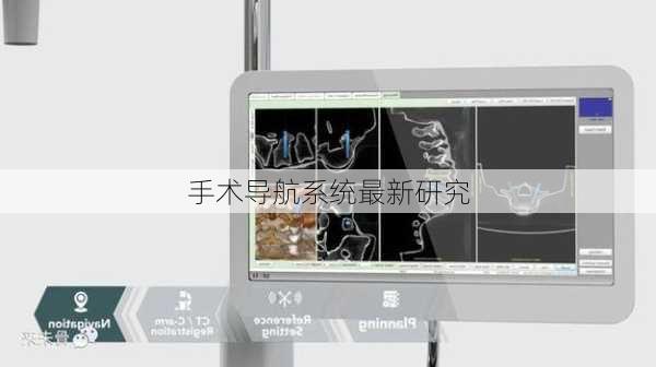 手术导航系统最新研究