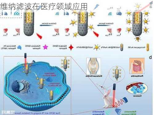 维纳滤波在医疗领域应用