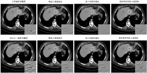 低剂量CT图像去噪的最新研究