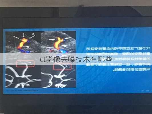 ct影像去噪技术有哪些