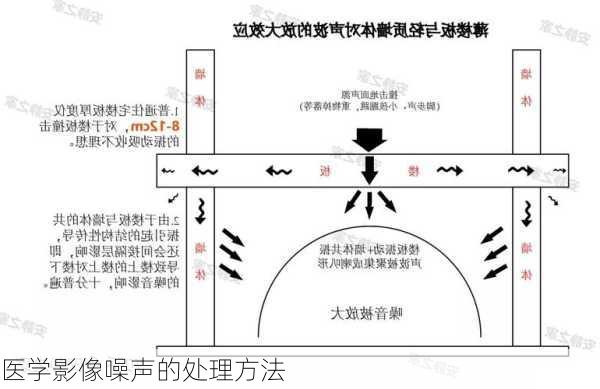 医学影像噪声的处理方法