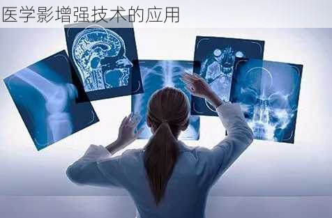 医学影增强技术的应用