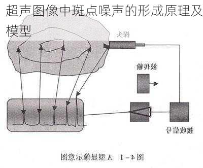 超声图像中斑点噪声的形成原理及模型