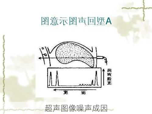 超声图像噪声成因