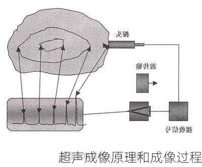 超声成像原理和成像过程