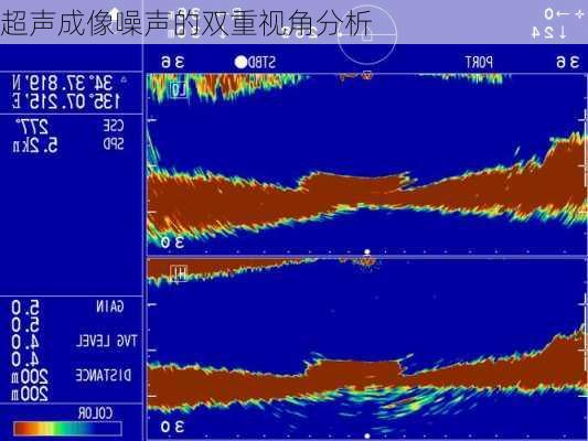 超声成像噪声的双重视角分析