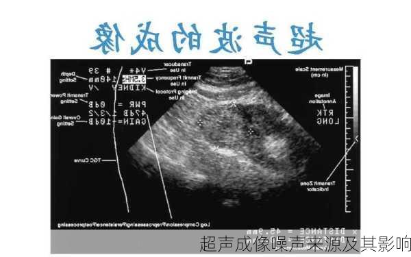 超声成像噪声来源及其影响