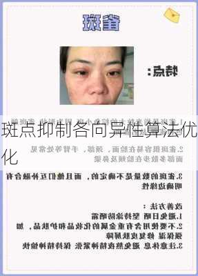 斑点抑制各向异性算法优化
