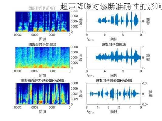 超声降噪对诊断准确性的影响
