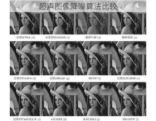 超声图像降噪算法比较