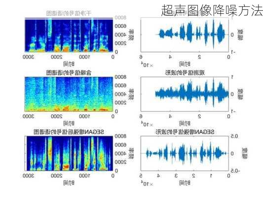 超声图像降噪方法