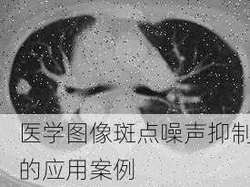 医学图像斑点噪声抑制的应用案例
