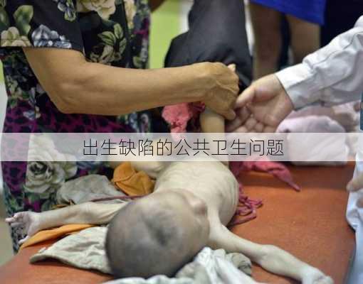 出生缺陷的公共卫生问题