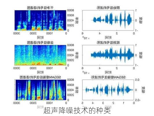 超声降噪技术的种类