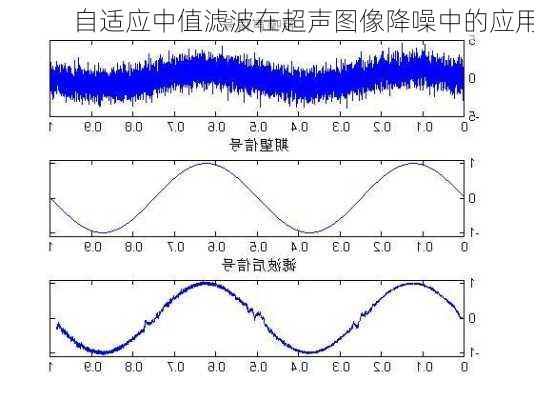 自适应中值滤波在超声图像降噪中的应用