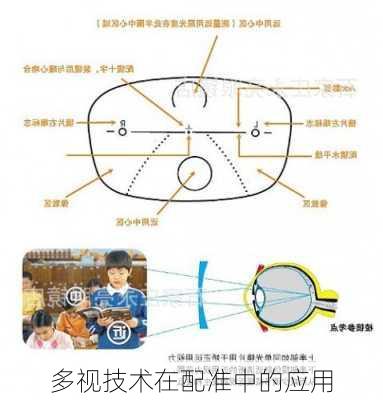 多视技术在配准中的应用