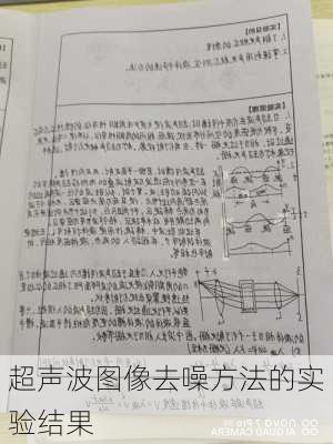 超声波图像去噪方法的实验结果