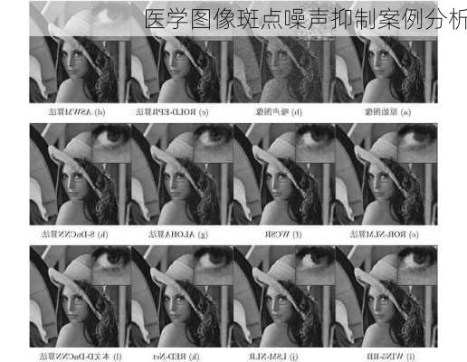 医学图像斑点噪声抑制案例分析