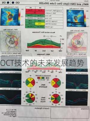 OCT技术的未来发展趋势