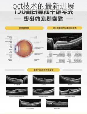 oct技术的最新进展