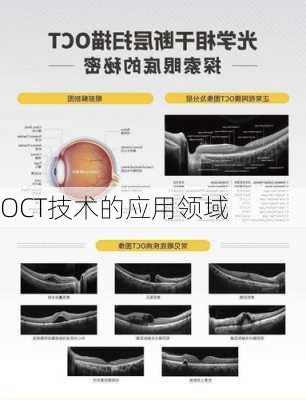 OCT技术的应用领域