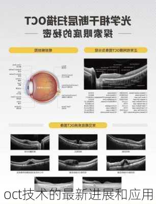 oct技术的最新进展和应用