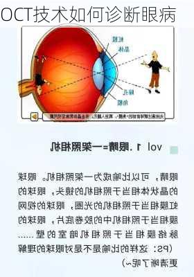 OCT技术如何诊断眼病