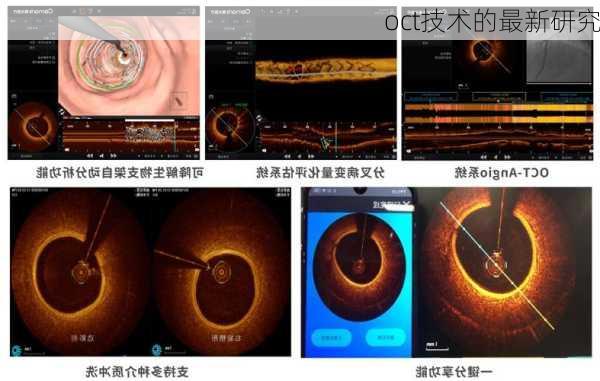 oct技术的最新研究