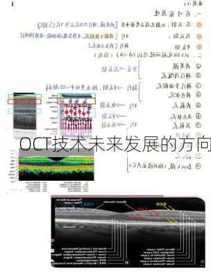 OCT技术未来发展的方向