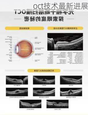 oct技术最新进展