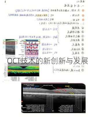 OCT技术的新创新与发展