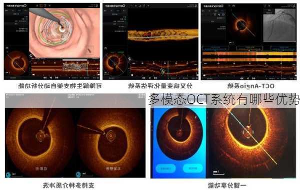 多模态OCT系统有哪些优势