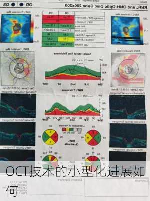 OCT技术的小型化进展如何