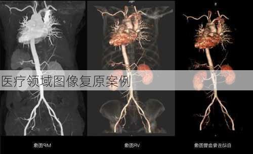 医疗领域图像复原案例
