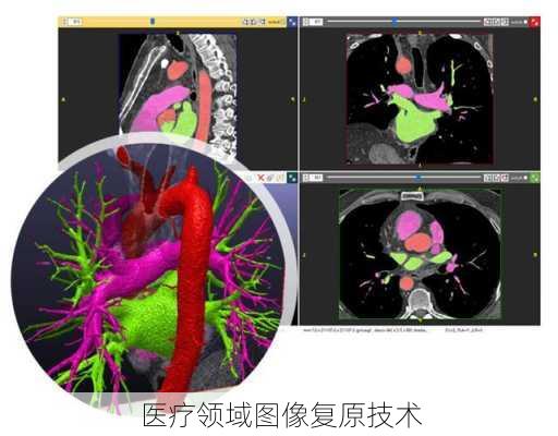 医疗领域图像复原技术
