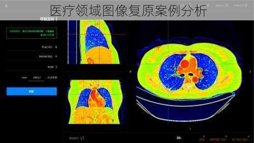 医疗领域图像复原案例分析