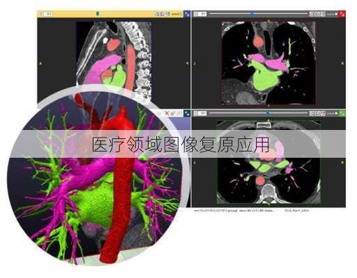 医疗领域图像复原应用