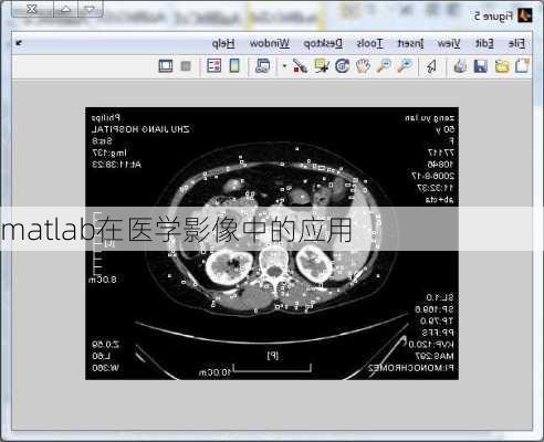 matlab在医学影像中的应用