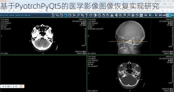基于PyotrchPyQt5的医学影像图像恢复实现研究