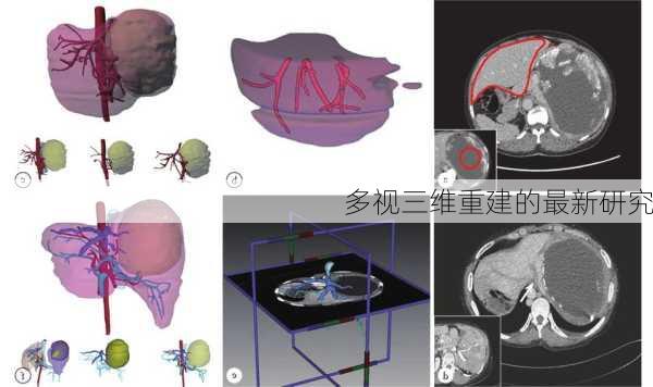 多视三维重建的最新研究