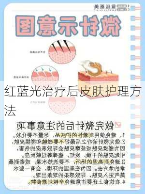 红蓝光治疗后皮肤护理方法