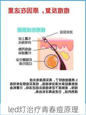 led灯治疗青春痘原理
