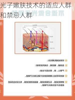光子嫩肤技术的适应人群和禁忌人群