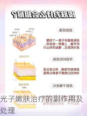 光子嫩肤治疗的副作用及处理