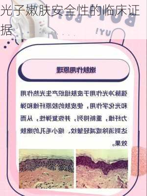 光子嫩肤安全性的临床证据