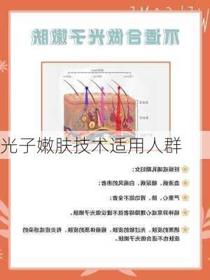 光子嫩肤技术适用人群