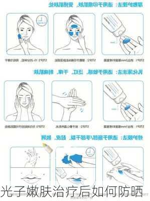 光子嫩肤治疗后如何防晒