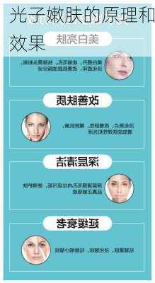 光子嫩肤的原理和效果