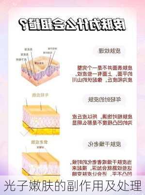 光子嫩肤的副作用及处理