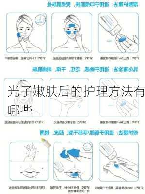光子嫩肤后的护理方法有哪些